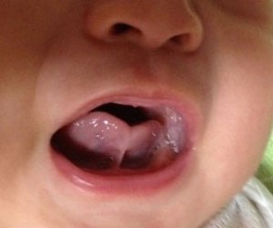 舌头下面那个“系带”，是干啥用的呢