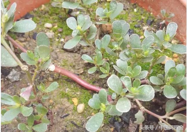 马齿苋治牙疼制作方法,马齿苋牙疼吃管用吗