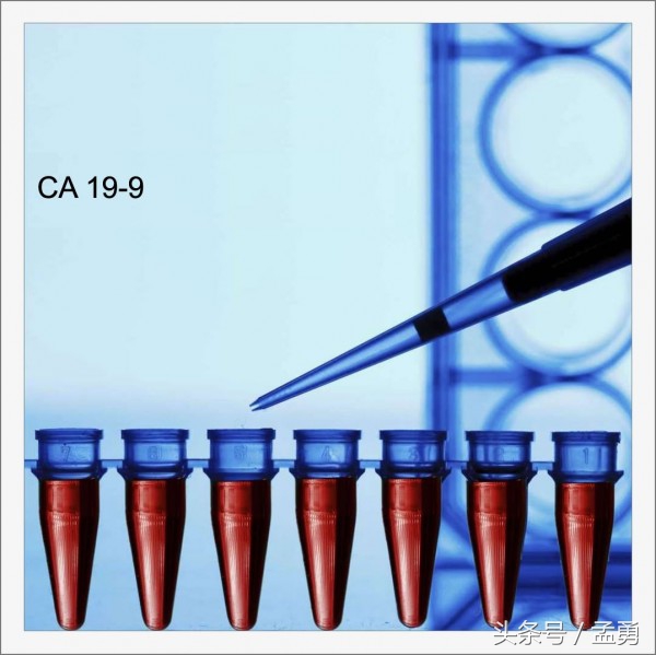 ca199升高怎么治疗,ca19937.3偏高吗
