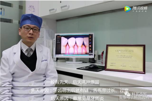 门牙旁边有缝最好的解决方法,门牙缝漏怎么补救