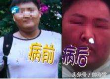 老人消肿止痛药,老人吃止痛药腿肿是什么原因