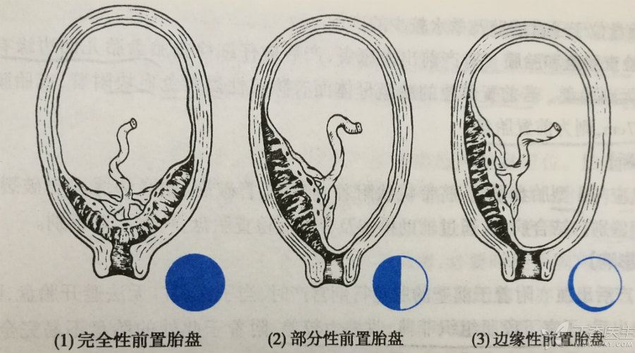 安全度过一个月的危险期,安全渡过难关