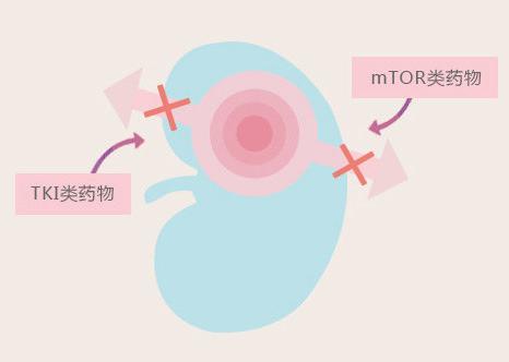tki靶向药和抗血管生成药品的区别,tki靶向药是医保药品吗