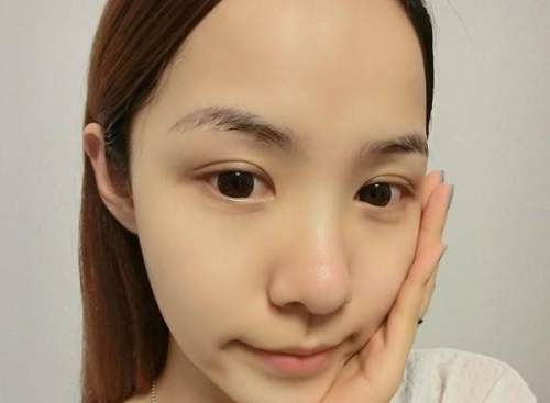 如何让脸变得没有痘变得更白净,脸上全是大大小小的红痘印