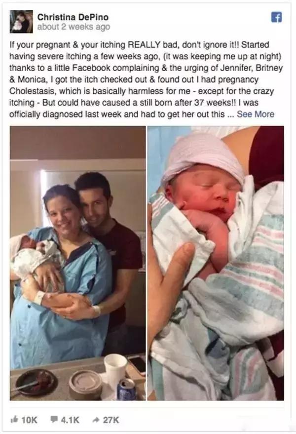 孕妇浑身发痒但是没症状,孕妇感觉到肚子里面痒痒的