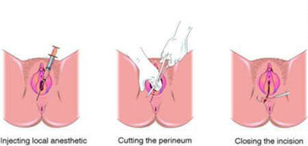 孕妈分娩时一定要注意这几个事项,孕妈产前需要了解的知识