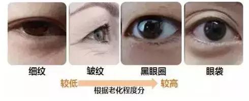 抢救假性眼纹、眼袋的黄金时间，错过你就老了
