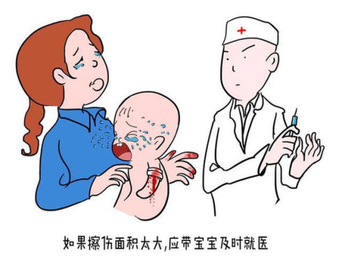 儿童意外急救小知识,儿童急救常识100个小知识