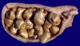 这项技术降低了那些无法承受手术病人的死亡率