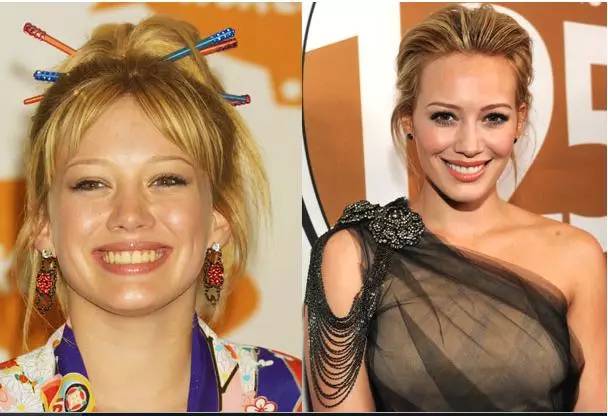 牙齿美白损伤最少的方法,想要牙齿美白这三招最管用