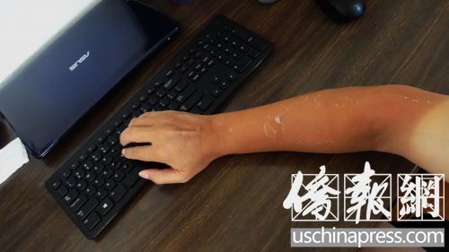 如何预防中暑专家支招