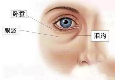 郑爽泪沟、眼袋明显到糊住镜头，学生*党**们的通病该怎么治？