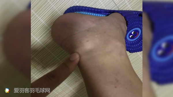 脚疼的15种原因和治疗方法,脚疼怎么才能彻底根治