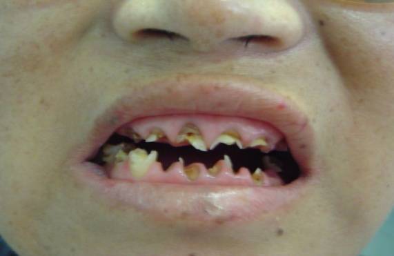 爸妈说你“二天”一定要得的这种病，到底是个啥子病？