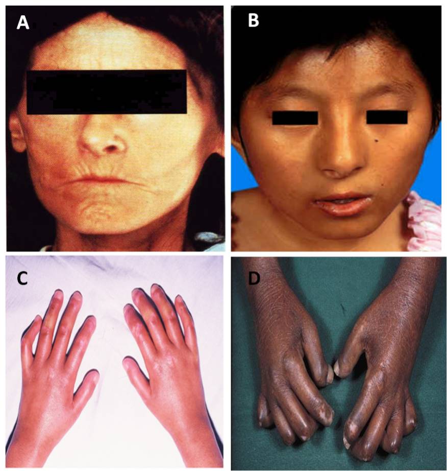 爸妈说你“二天”一定要得的这种病，到底是个啥子病？
