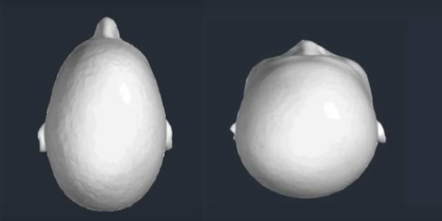 戴眼镜下滑解决方法,戴眼镜怎么防止掉下来