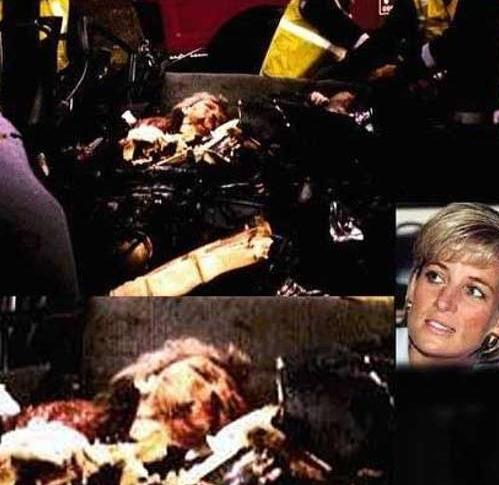 戴安娜王妃逝世20周年,戴安娜王妃死因大揭秘