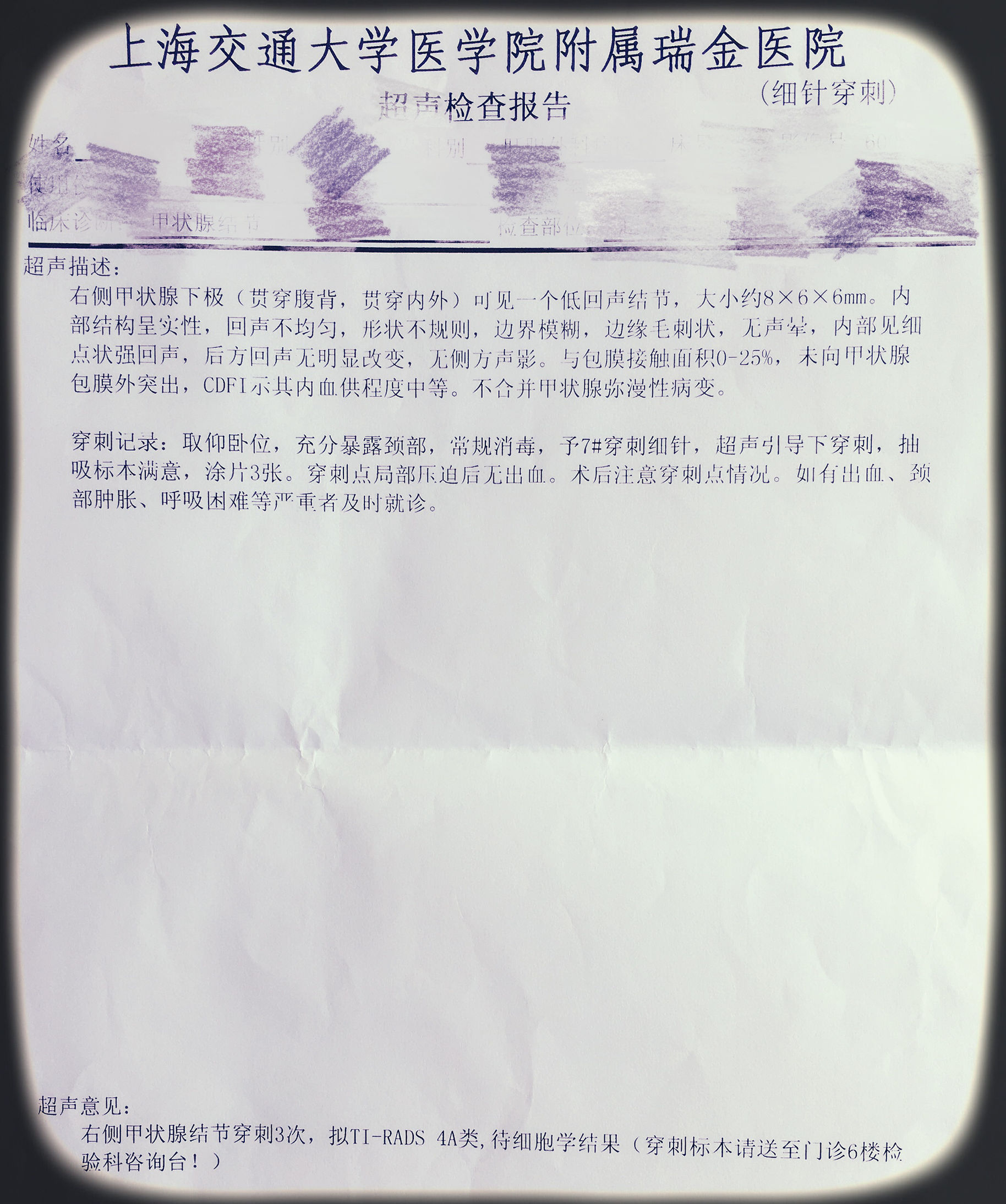 大部分甲状腺癌术后预后好死亡率,为啥甲状腺癌穿刺后建议尽早手术