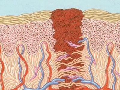 650nm弱激光对人的好处,弱激光照射的好处