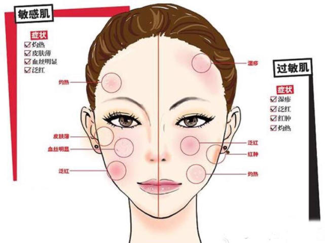 面部突然发红起皮,面部突然局部泛红干痒