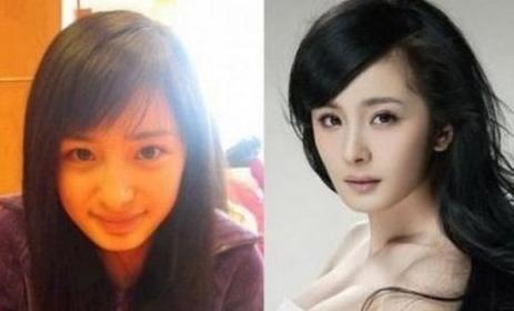 鼻子整形的方法有几种,鼻子整形能改变容貌吗