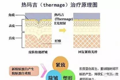当青春变成了鱼尾纹,青春鱼尾纹
