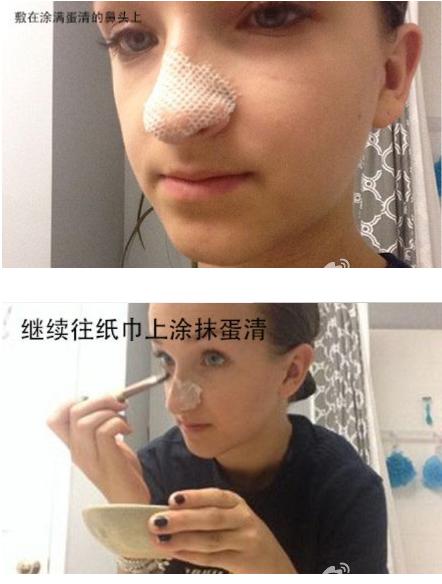 男士面膜去黑头收缩毛孔痘印,清洁面膜收缩毛孔控油去黑头