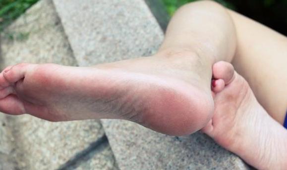 脚干裂怎么办？看中医怎么说？