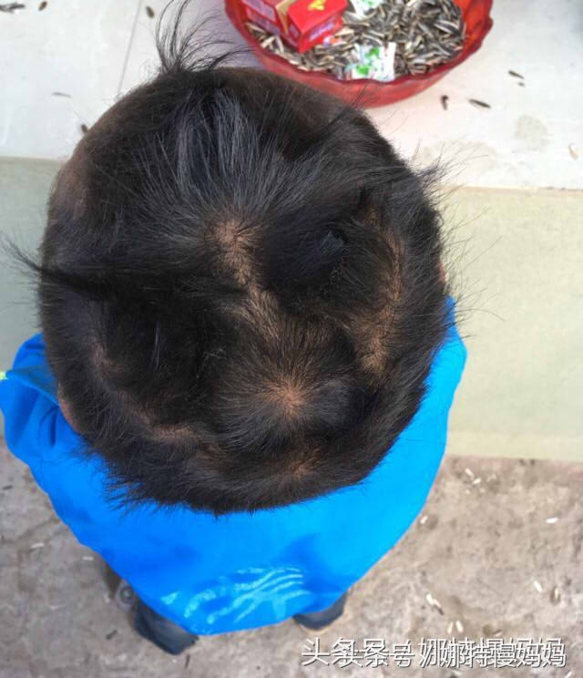 宝宝头旋儿到底有几个好？家长必须了解的秘密！