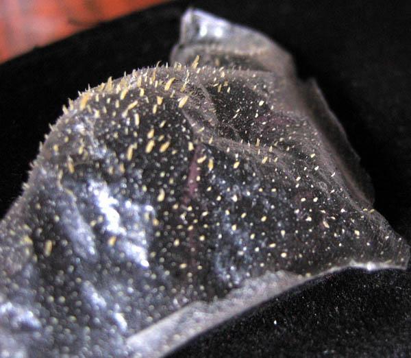 祛黑头最有效方法,祛黑头最好方法