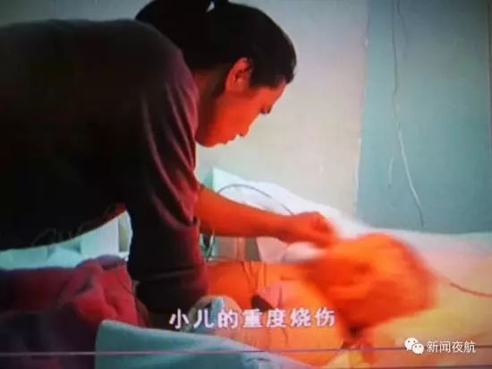 宝宝怎么防冻伤,宝宝烫伤天气热怎么护理