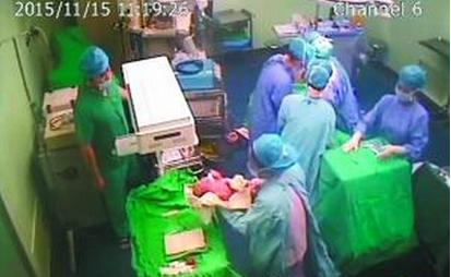 产检双胞胎生单胎,产检时是单胎却生下双胞胎为什么