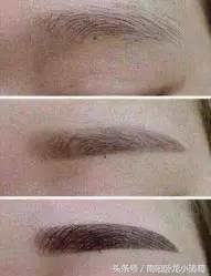 南阳时光整形美容,南阳提眉整形