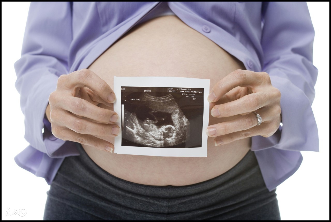 顽固多囊终升级，细数我的好孕经验！接棒吧！