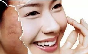 北京国医堂看痘痘哪个医生比较好,北京国医堂看痘痘