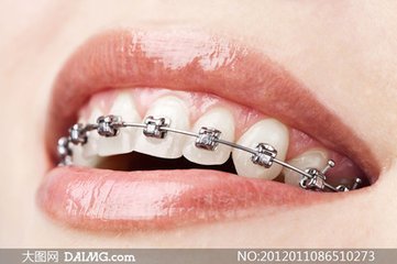 做了美容牙冠后悔了怎么补救,美容冠修复龅牙