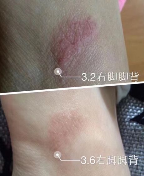 热卖｜素颜拼过谢娜？你值得拥有Ta！