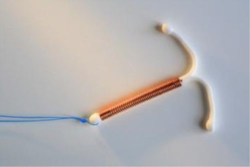 取环有什么讲究吗,取环容易出现什么意外