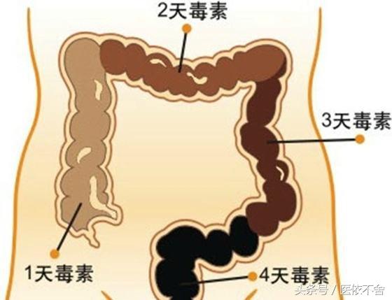 肠蠕动慢便秘怎么饮食,治便秘肠道变黑怎么治最好
