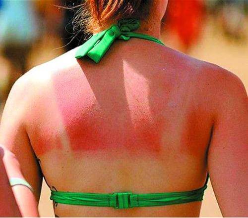 晒黑后可以变得比原来更白吗,晒黑后皮肤如何白回来教你小方法