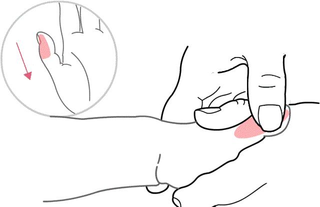 妈妈咳嗽怎么治疗,新妈妈应对宝宝咳嗽的小偏方