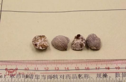 草豆蔻和肉豆蔻的区别是什么,肉豆蔻和草豆蔻区别