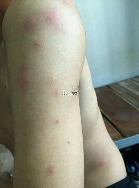 宿舍臭虫多请问用什么药杀虫有效,家里发现臭虫如何防治