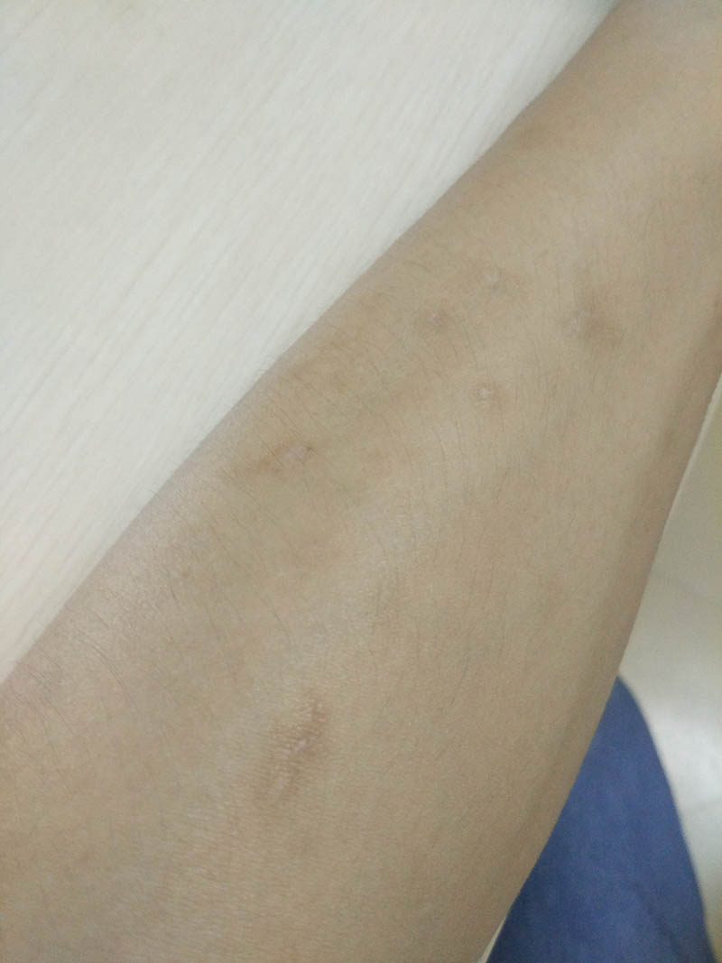 宿舍臭虫多请问用什么药杀虫有效,家里发现臭虫如何防治