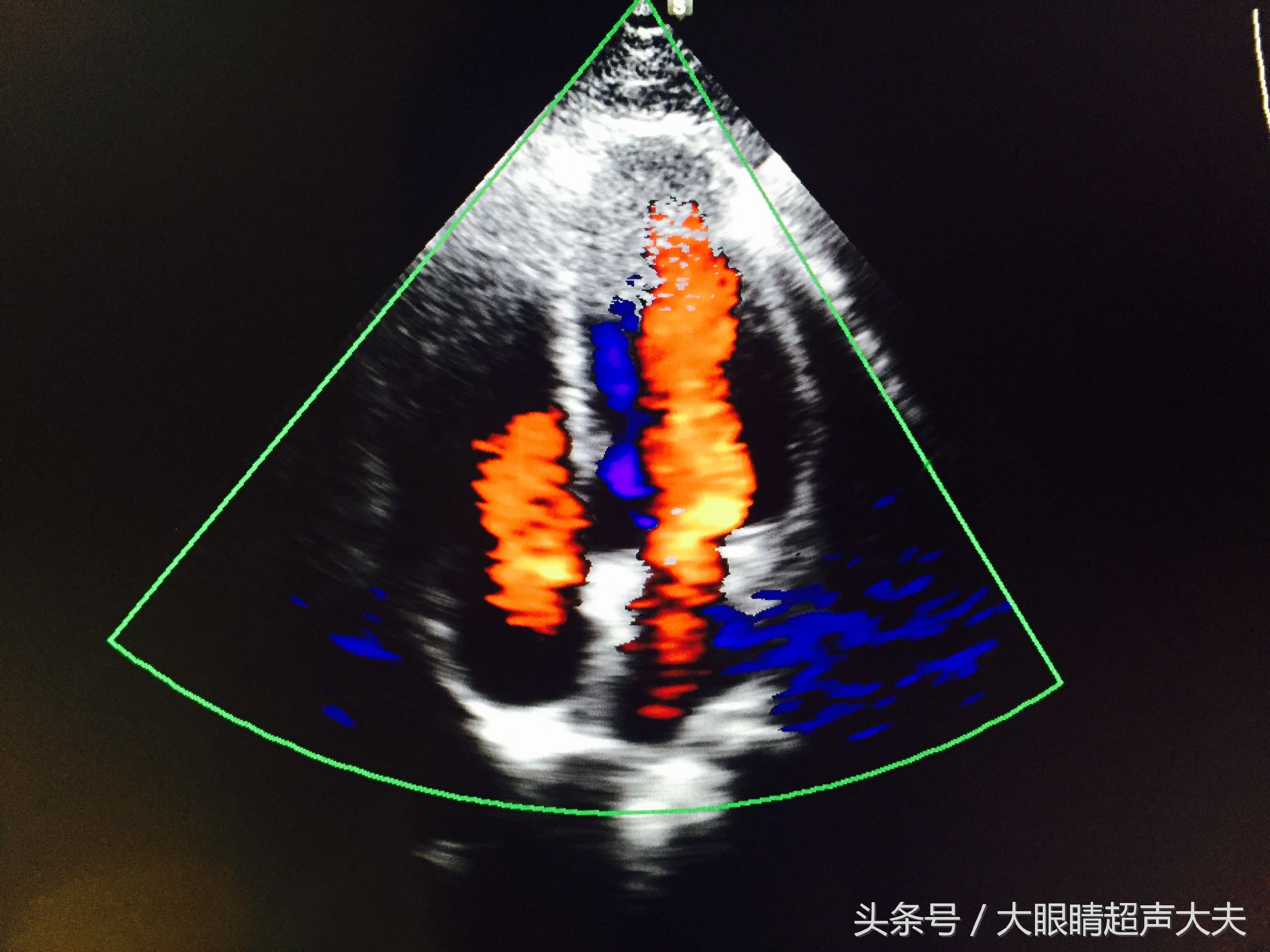 超声检查报告单搞笑图,有趣的超声图