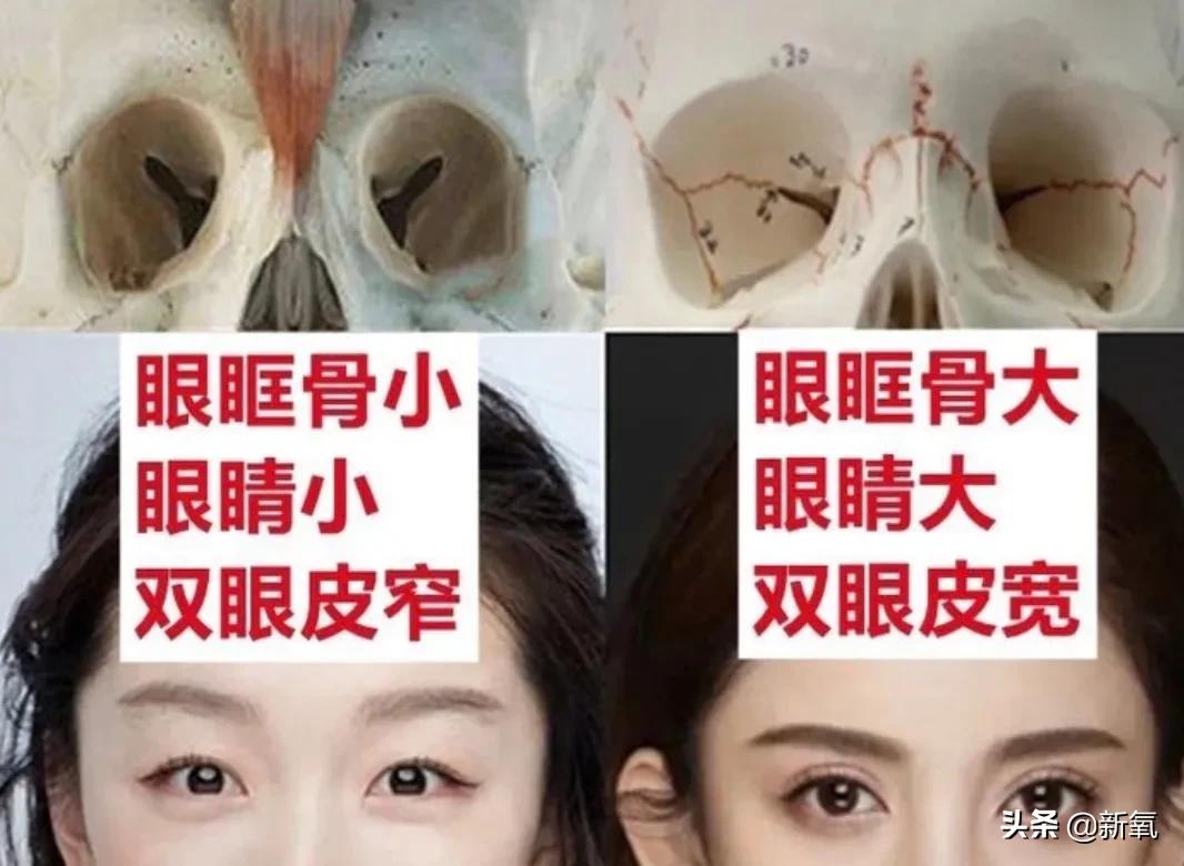 姐妹单眼皮双眼皮,姐妹们你们割双眼皮多少钱