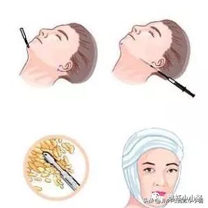 日本小姐姐针灸瘦脸视频,小姐姐打瘦脸针视频