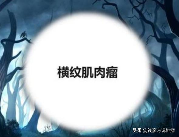 中晚期肿瘤最佳治疗方法是什么,膀胱癌肿瘤晚期吃中药有用吗