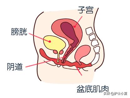 打喷嚏漏尿莫大意，盆底疾病缠住你，切勿病急乱投医，一文解难题