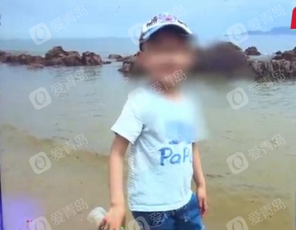 青岛幼儿园男孩头部受伤,青岛幼儿园5岁男孩摔伤后续